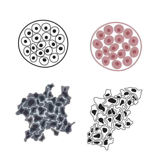 恶性和良性肿瘤的载体说明图片下载