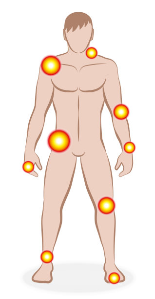 关节和肌肉疼痛。男性身体疼痛部位-颈部疼痛，膝盖问题，臀部疼痛，风湿，炎症，关节炎。孤立的矢量插图上的白色。图片下载