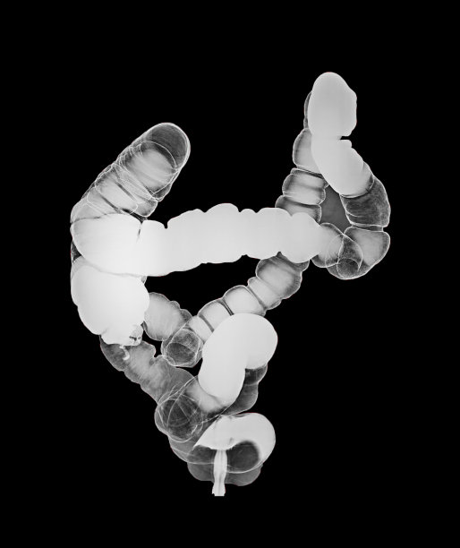 大肠钡剂灌肠片或x线片，俯卧位显示结肠解剖结构以检测结肠癌。剪切路径。图片下载