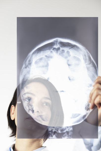 女医生在看x光片图片下载