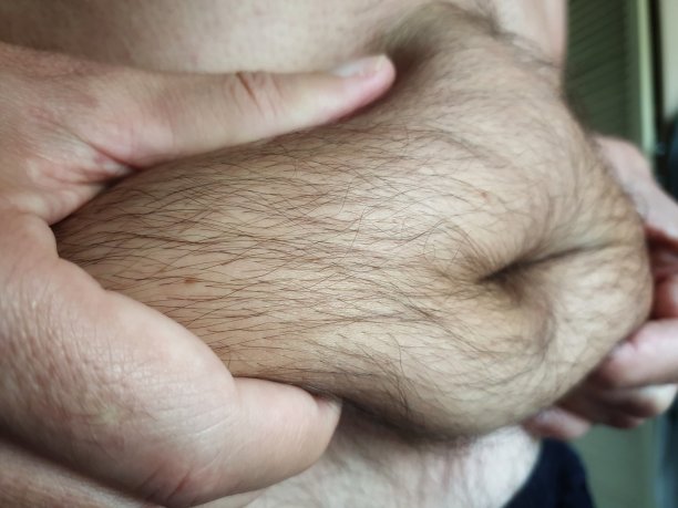 肥胖和营养不良，腹部赘肉图片下载