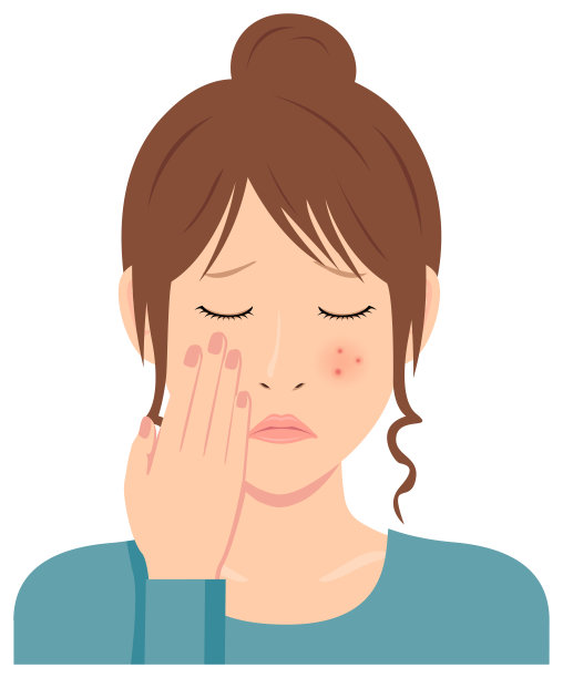 年轻女性载体插图(上半身)/痤疮，丘疹，斑点，皮疹图片下载