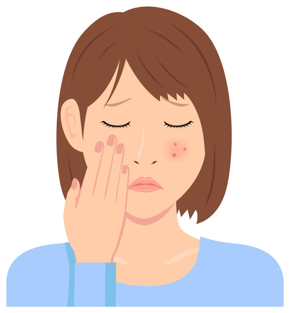 年轻女性载体插图(上半身)/痤疮，丘疹，斑点，皮疹图片下载