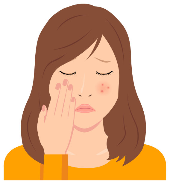 年轻女性载体插图(上半身)/痤疮，丘疹，斑点，皮疹图片下载