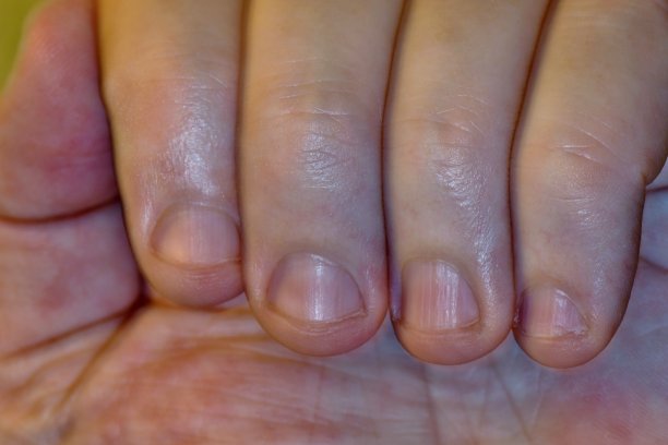 近距离观察咬指甲的习惯。图片下载