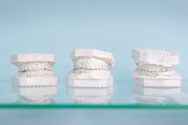 在牙医办公室的玻璃架子上，以浅蓝色为背景的不同石膏犹太人模型。牙科和义肢实验室。支架和假体植入形式的铸造图片下载