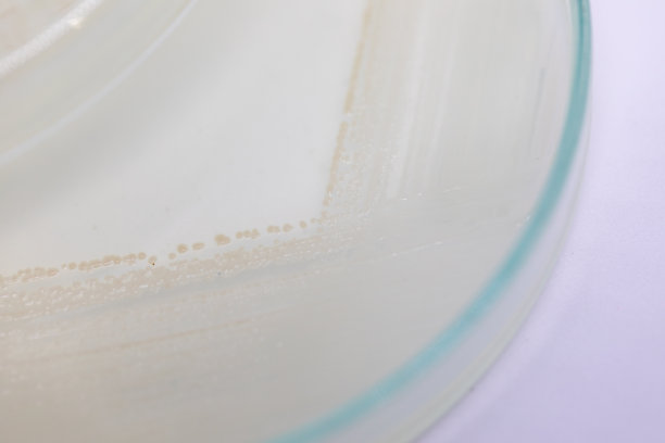 教育用培养皿中酵母菌落特性研究。图片下载