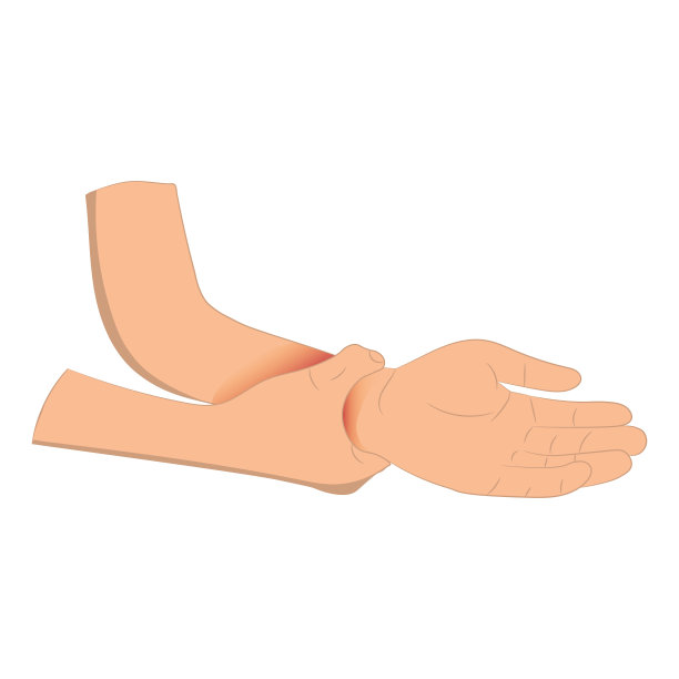 腕部疼痛，男子握腕部疼痛是因为腕部韧带部位，矢量图解概念疾病与保健图片下载