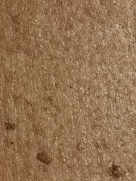 老人的皮肤图片下载