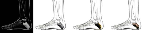 跟骨收集的3d渲染图图片下载