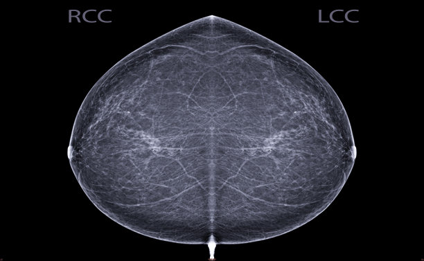 乳腺X光数字钼靶摄影（CC位）：用于检测女性乳腺癌图片下载
