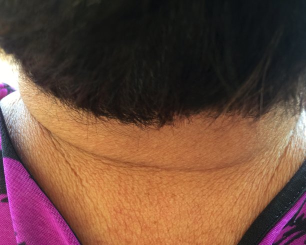 在一个又老又胖的女人脖子后面图片下载