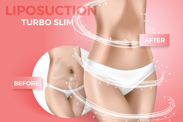 矢量插图关于抽脂，之前和之后。减肥方案，逼真女性身材苗条和肥胖。图片下载