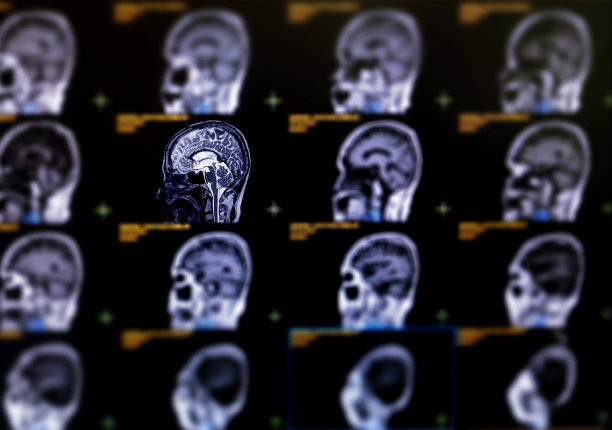 脑部矢状面MRI的焦点选择照片图片下载