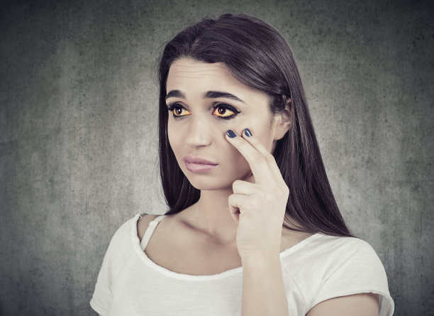 照镜子的病人眼睛呈黄色，这可能是肝脏感染或其他疾病的征兆图片下载