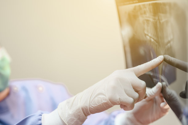 女医生拿着病人的牙齿x光片进行有效治疗，改善病人的牙齿健康和灿烂的笑容。图片下载