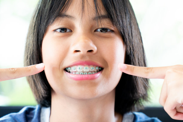 戴着牙套的女孩微笑着，很开心图片下载