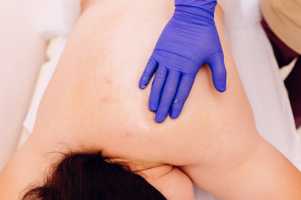 中国传统按摩——刮痧图片下载