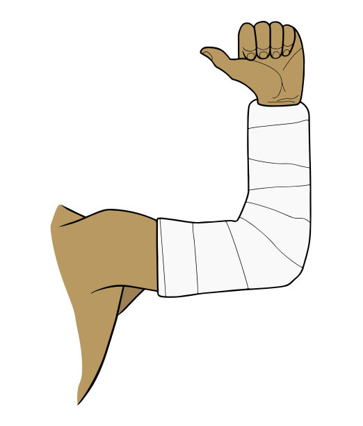 男性的手在石膏石膏。骨折愈合。矢量插图。图片下载