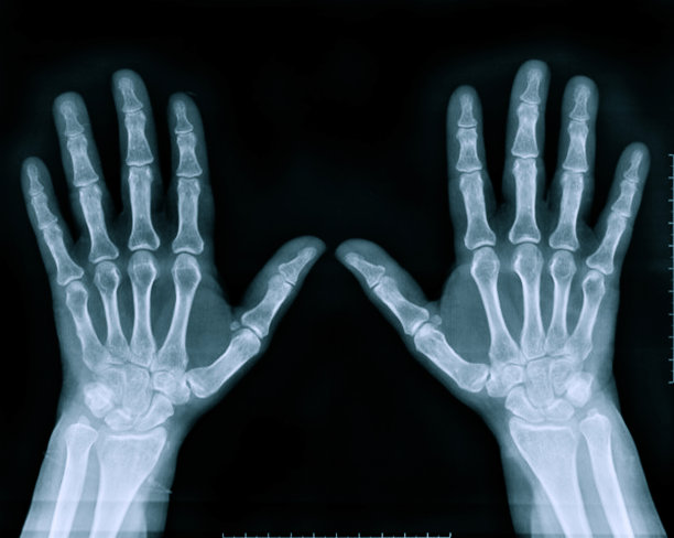 x射线的手图片下载