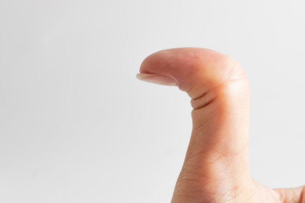 白种人女性的手与超级灵活的拇指。弯曲的拇指，搭便车者拇指综合症。关闭了。图片下载