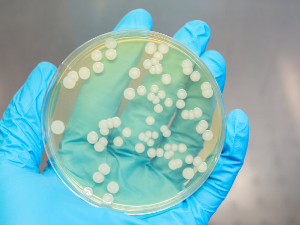 在细菌实验室的层流柜中，手持一个装有分离菌落的有盖培养皿图片下载