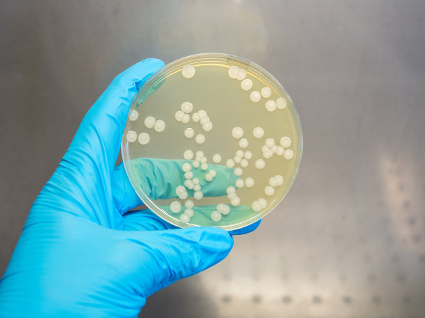 在细菌实验室的层流柜中，手持一个装有分离菌落的有盖培养皿图片下载