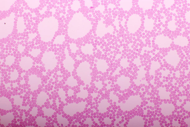 血液涂片中的红细胞图片下载