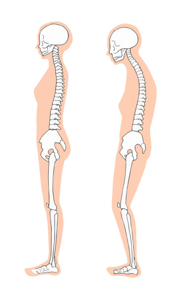 女性正确且骨骼不良图片下载