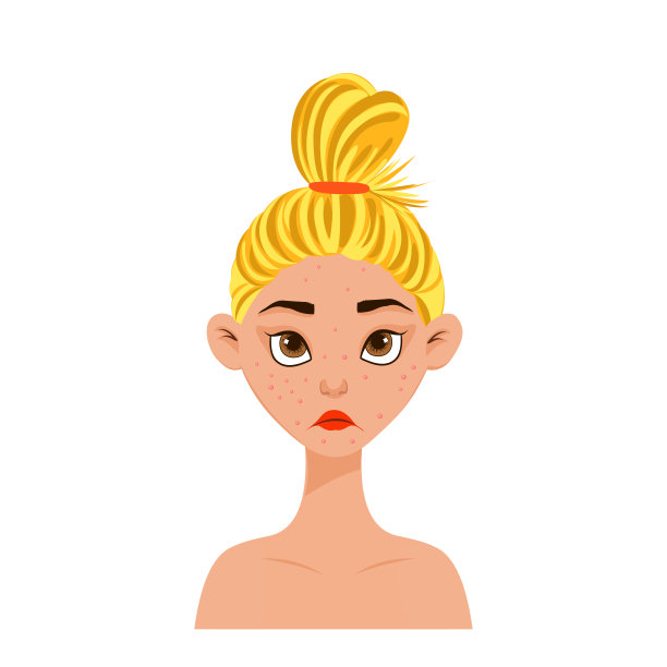 美女脸上长着粉刺。卡通风格。矢量插图。图片下载