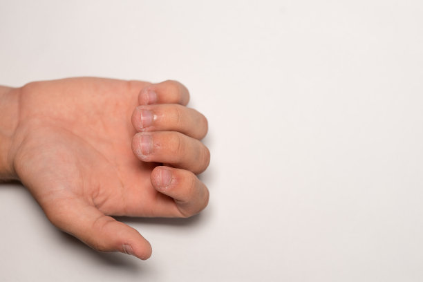 被咬过的指甲不好看图片下载