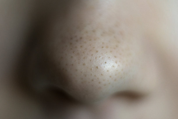 鼻子上的黑点。关闭了。图片下载