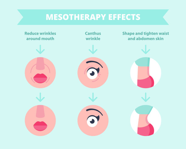 中光疗法治疗效果及前后效果:减少脸部皱纹、紧腰。彩色扁平纸箱矢量概念插画，展示了光疗法在美容美容方面的优势。图片下载