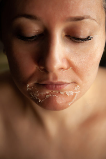 去除脸上的皮肤。女人的脸经过化学脱皮。去除旧皮肤的角质。图片下载