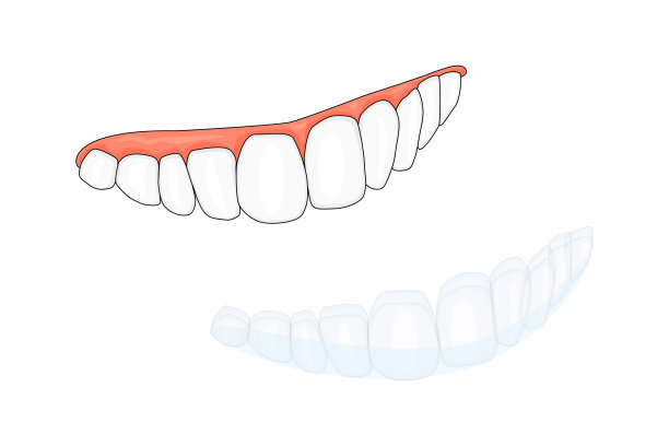 牙齿和无齿矫正器或隐形固位体孤立在白色背景上。图片下载