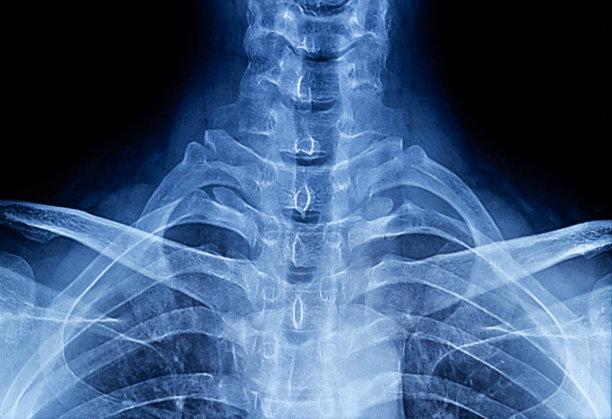 颈部x光片图片下载