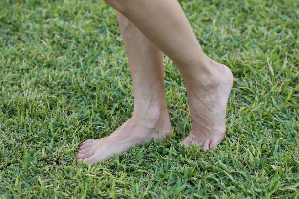 女性腿上有静脉曲张和蜘蛛静脉图片下载