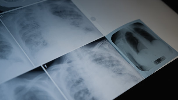 肺放射学概念。放射科医生在病房检查病人的胸部x光片。图片下载