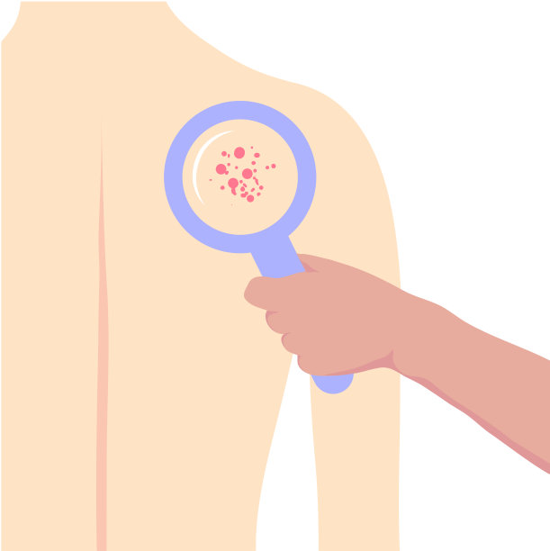 皮肤科医生用放大镜检查病人的皮肤。图片下载