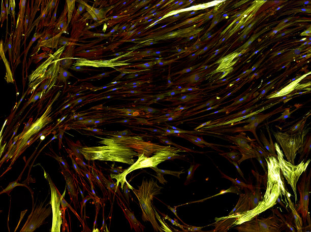 真实荧光显微镜观察人类细胞-人类肺成纤维细胞图片下载