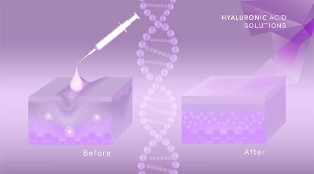 透明质酸广告护肤液前后，紫色胶原蛋白血清滴液配合化妆品广告背景即可使用。图片下载