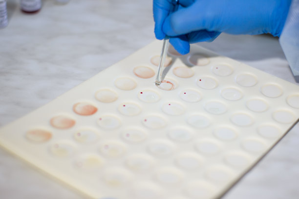 血液测试图片下载