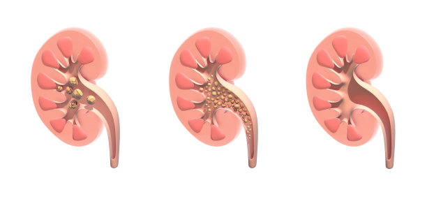 肾脏内部的三维解剖图。图片下载