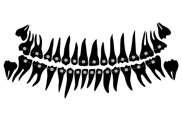 青少年牙齿轮廓与牙套。矢量图图片下载