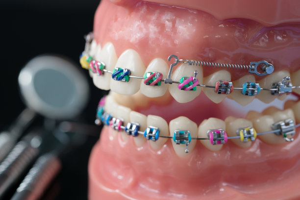 正畸模型图片下载