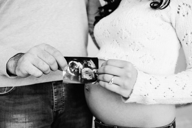 一对怀孕夫妇手里拿着他们宝宝的超声波扫描图。一个男人，丈夫在家里拥抱他怀孕的妻子。幸福家庭怀孕，期待。黑白照片扫描。图片下载