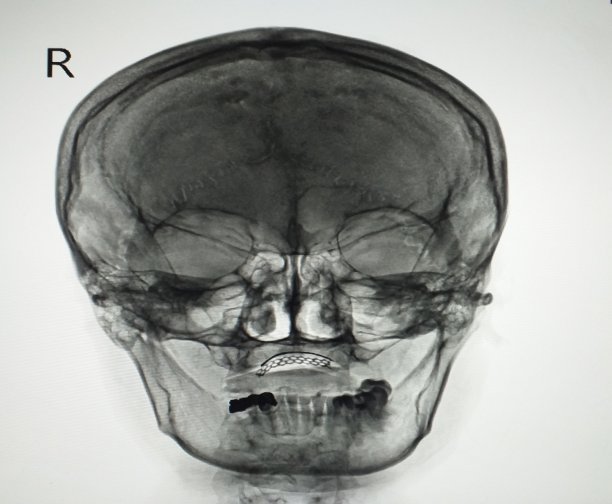 x射线的头骨图片下载