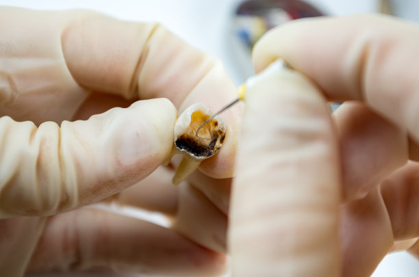 牙科治疗上的白色背景近景微距图片下载