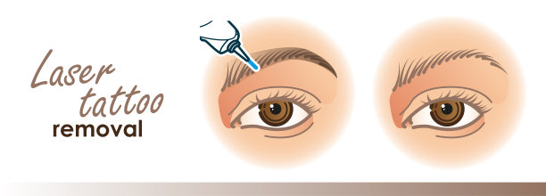 眉毛去除程序说明。激光纹身去除图标，微刀片图片下载