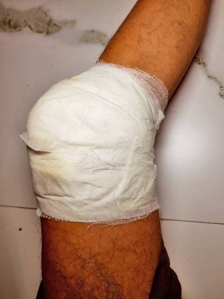 受伤的膝盖包扎图片下载